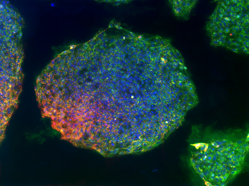 Замороженные индуцированные плюрипотентные стволовые клетки (iPSCs), полученные из клеток кожи. Синим представлена вся ДНК; зеленый и красный указывают на поверхностные белки на плюрипотентных клетках.