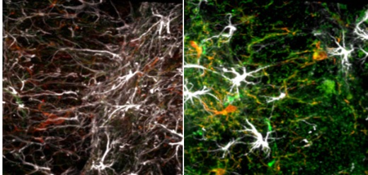 В отличие от старого мозга (справа) в микроглии в молодом мозге мало TGF-beta1 (показан зеленым).