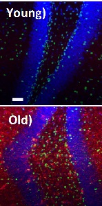 В клетках гиппокампа фактор роста TGF-beta1 (окрашен на снимке красным) практически не присутствует в молодой ткани, но повсеместно распространен в старой ткани, где он подавляет функцию стволовых клеток и способствует старению.