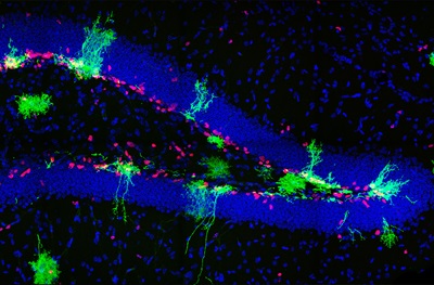 Зубчатая извилина гиппокампа мыши на 7-й день после рождения, синий цвет - маркер ядер, зеленый – маркер потомства HOPX-экспрессирующих клеток-предшественников, красный - маркер клеточной пролиферации.