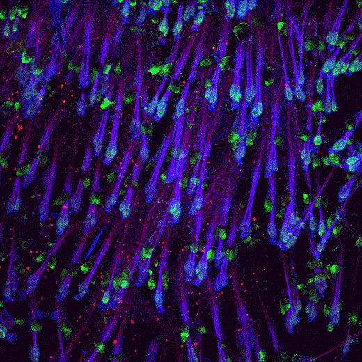 Стволовые клетки эпидермиса взрослой мыши (зеленым показан цитокератин 6, синим – клеточные ядра). В этих клетках белок Sox4 поддерживает тканевый гомеостаз.