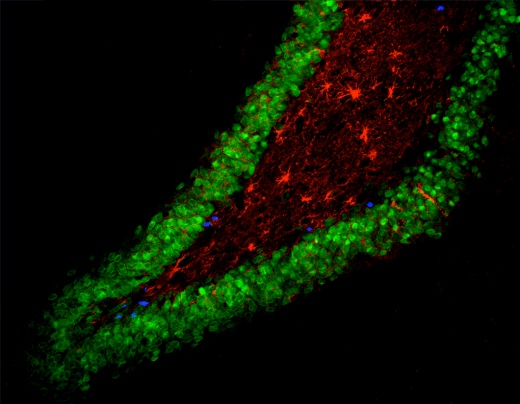 Срез головного мозга крысы с нейральными стволовыми клетками (синие), которые делятся в течение всей жизни, производя астроциты (красные) и зрелые нейроны (зеленые).