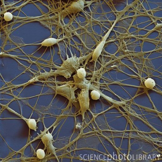 Человеческие нейральные клетки-предшественники занимают положение между полностью дифференцированными и  стволовыми клетками. Они не могут, как стволовые клетки, развиться в любой тип клеток, но могут дифференцироваться в различные типы клеток нервной системы (нейроны, астроциты и олигодендроциты). (СЭМ).