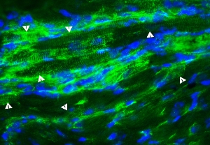 Введение стволовых клеток, полученных из кровеносных сосудов, стимулирует образование новых кардиомиоцитов (показаны стрелками) уже присутствующими в сердце нестин-положительными стволовыми клетками.