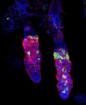 Иммуноокрашивание трансгенного (кератин-15-зеленый флуоресцентный белок) репортера (зеленый) в эпидермисе хвоста мыши выделяет популяцию стволовых клеток, подвергающихся возрастным изменениям.