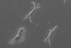 Полученное с помощью сканирующего электронного микроскопа изображение человеческих мезенхимальных стволовых клеток, растущих на подложке с короткими  микростолбиками. Через 1 сутки культивирования эти клетки растянулись  больше, чем клетки, культивируемые на длинных микростолбиках. Они превратятся в костные. Хотя такие клетки наклоняют свои короткие микростолбики меньше, чем  клетки, растущие на длинных микростолбиках, чтобы достичь этого, им  нужно оказывать на микростолбики большую силу.