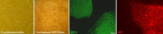 Человеческие клетки амниотической жидкости (первый фрагмент слева) до перепрограммирования в iPS-клетки амниотической жидкости (второй фрагмент слева), внешне неотличимые от эмбриональных стволовых клеток. iPS-клетки амниотической жидкости продуцируют белок OCT4 (зеленый) – один из важнейших маркеров стволовых клеток. Начиная с этой эмбриональной стадии стволовых клеток, iPS-клетки амниотической жидкости могут дифференцироваться в клетки, близкие к гепатоцитам, и другие клетки. Они синтезируют плазменный белок альфа-фетопротеин (красный), в изобилии обнаруживаемый в печени эмбриона.