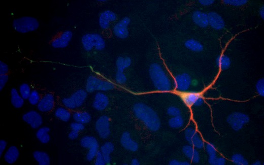 Ученые Рурского университета в Бохуме трансформировали нейральные стволовые клетки спинного мозга мыши в нейроны, один из которых показан на фото. Главный отросток нейрона – аксон – окрашен зеленым, другие отростки – дендриты – красным, ядра клеток – синим.