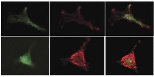 Простагландины «охраняют» кроветворные стволовые клетки, усиливая синтез ингибирующего фактора мезенхимальными клетками костного мозга. Мезенхимальные клетки помечены зеленым белком (слева); ингибирующий фактор – красный. Комбинированное изображение (справа): обработка простагландинами (внизу) усиливает секрецию ингибирующего фактора.