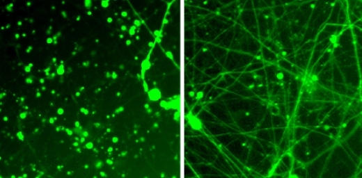 Ученые из Института Солка показали, что рапамицин (правый снимок) спасает нейроны, несущие мутацию синдрома Лея.