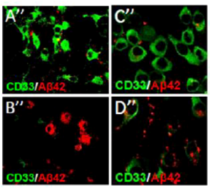 Активность регуляторного белка CD33 (зеленый) препятствует удалению разрушающих мозг биохимических отходов – бета-амилоидного белка (красный) – клетками микроглии. Слева: в микроглии нормальных контрольных мышей (А) больше CD33 и меньше бета-амилоида, чем у мышей с экспериментально подавленной экспрессией CD33 (B). Справа: меньше бета-амилоида можно видеть в микроглии  мышей линии с повышенной экспрессией CD33 (С), по сравнению с микроглией животных, у которых экспрессия CD33 экспериментально подавлена (D). Данные, полученные на посмертных образцах человеческого мозга, показывают, что повышенная экспрессия CD33 наблюдается и при болезни Альцгеймера, предполагая, что препараты, подавляющие активность белка, могут помочь в лечении или предотвращении этого заболевания.