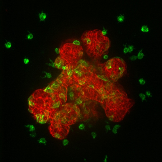 Нормальные клетки эпителия (красные) в этом фрагменте протока молочной железы мыши образуют разветвленные структуры, в то время как клетки, в которых активен ген Twist1 (зеленые), отделяются от соседних клеток и мигрируют в окружающую среду.