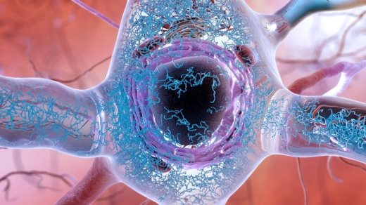 Аномальные скопления тау-белка наносят вред синаптическим связям между нейронами, образуя в них запутанные нити.