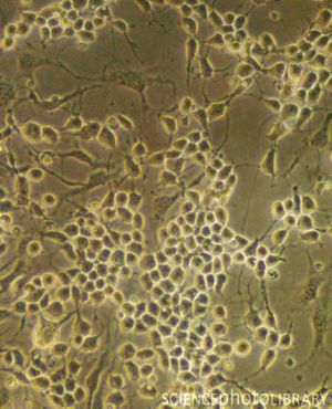 Нейральные стволовые клетки. Световая микрофотография самообновляющихся нейральных стволовых клеток из мозга мышиного эмбриона. Эти стволовые клетки могут в конечном итоге дифференцироваться в нейроны, астроциты или олигодендроциты.
