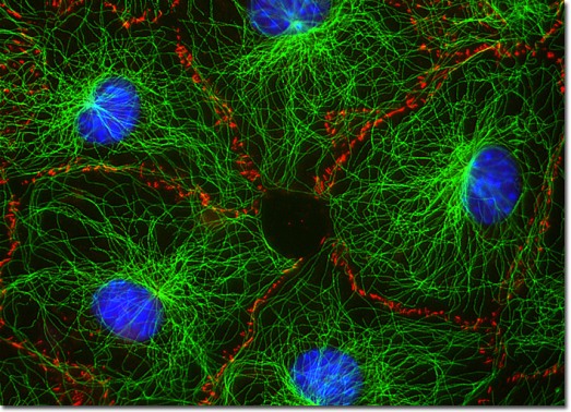 Мышиные фибробласты. Флуоресцентные метки позволяют визуализировать микротрубочки и актиновый цитоскелет.
