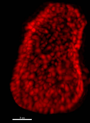 Ядро клетки мозга крысы. Каждое красное пятно – отдельный комплекс ядерной поры, клеточной структуры, находящейся в окружающей ядро мембране, имеющей важнейшее значение для связи между ядром и остальной частью клетки. Ученые из Института Солка занимаются изучением долгоживущих белков, являющихся важными структурными компонентами этих комплексов.