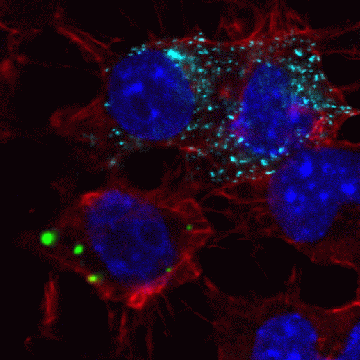 Нервные клетки под микроскопом: распространение белковых частиц из клетки в клетку. Контакт клеток, продуцирующих белковые частицы (окрашены бирюзовым), приводит к отложению в соседних клетках того же белка (зеленый). Синим окрашены ядра клеток.