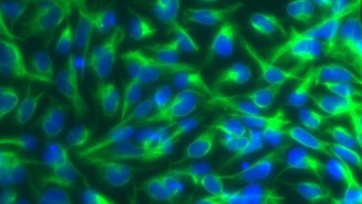 Нейральные стволовые клетки. Клетки этого типа были использованные для лечения мышей с моделью бокового амиотрофического склероза.