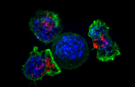 Т-клетки-киллеры окружают раковую клетку