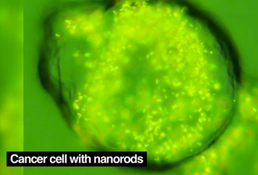 Раковая клетка с наностержнями. Наностержни, имеющие размер небольшого вируса, могут поглощать свет и преобразовывать его в тепло. Но так как одна наночастица способна излучать очень небольшое количество тепла, для уничтожения клетки их нужно очень много.