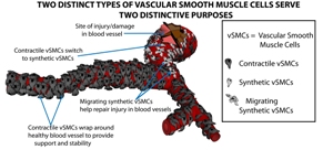 Два типа клеток гладкой мускулатуры сосудов выполняют разные функции. Сократительные клетки (contractile vSMCs) покрывают здоровый сосуд, поддерживая его и обеспечивая стабильность. Синтетические, в том числе мигрирующие,  клетки (synthetic vSMCs) занимаются восстановлением поврежденного сосуда.