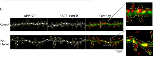 Везикулы, содержащие АРР (зеленые) и BACE-1 (красные), как правило, физически отделены друг от друга. Стимуляция нейронов глицином, усиливающая синтез бета-амилоида, значительно повышает колокализацию APP/BACE-1 в дендритах (показана желтым).