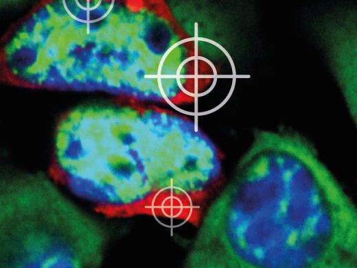 Белковые агрегаты, по-видимому, ответственны за смерть нервных клеток при нейродегенеративных заболеваниях – болезни Альцгеймера, болезни Паркинсона, боковом амиотрофическом склерозе и болезни Хантингтона. Чтобы белковые агрегаты (красные) в клетках можно было увидеть в микроскоп, их нужно предварительно окрасить. На снимке ядра клеток - синие, мРНК – матрицы для образования белков – зеленые.