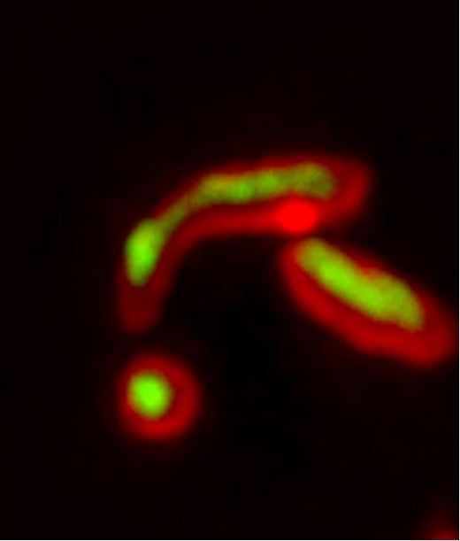 Митохондрии (красные) с импортированными в них неправильно свернутыми белками (зеленые)