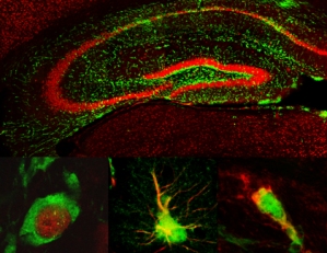 Нейральные стволовые клетки показаны зеленым, нейроны – красным.