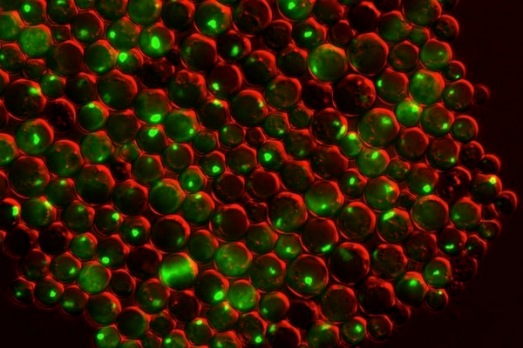 Зеленые пятна сверху – скопления белков внутри дрожжевых клеток с дефицитом как цинка, так и белка, предотвращающего образование агрегатов. Ученые Висконсинского университета в Мэдисоне изучают, как дефицит цинка может способствовать развитию заболеваний.